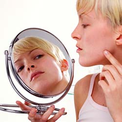 Worried About The Acne Scar? Here’s A Solution!