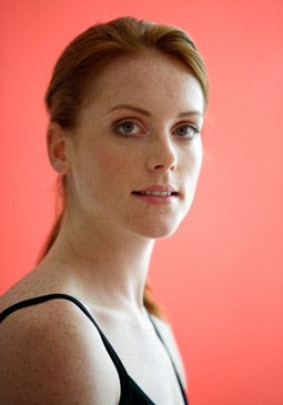 Melasma Is The Skin Discoloration Problem In Women!