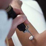 Laser Hair Removal Can Be Very Effective