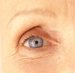 eye wrinkle