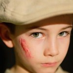 Dealing With Painful Keloid Scars