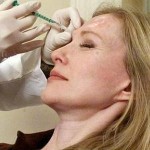 botox injection