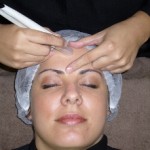 Microdermabrasion And Its Common Uses