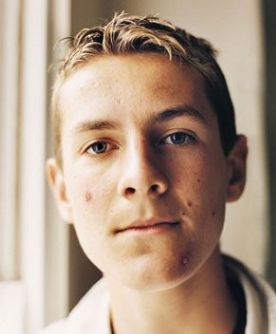 Laser Skin Treatments Laser Skin Treatments