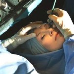 The Future Has Arrived in the Form of Skin Laser Treatment