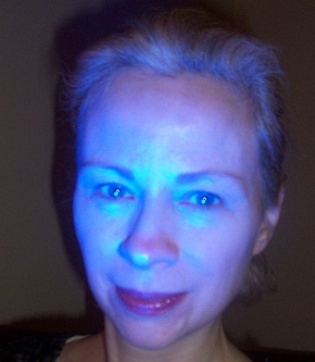  Blue Light Therapy
