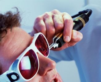 Permanent Hair Removal for Men