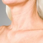 How Important Is Your Skin Pigmentation?