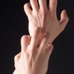 Itchy Skin No Rash: What Does It Mean?