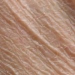 Dry Scaly Skin