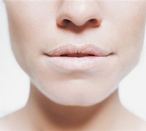 Chapped Lips