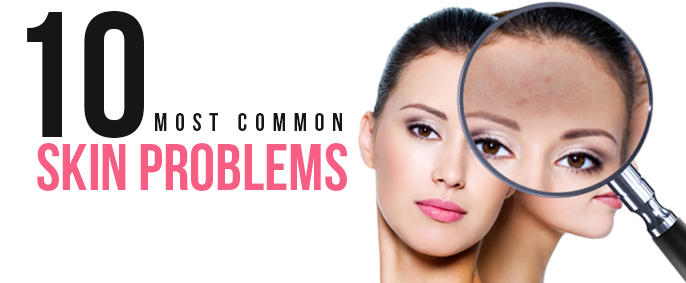 Most Common Skin Problems