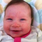 Rashes on babies