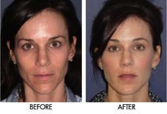 Revive Skin Care Side Effects