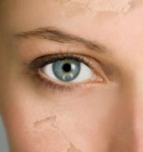 dry facial skin dry facial skin