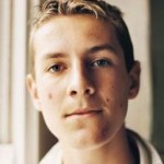 10 Common Acne Myths and Facts