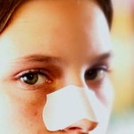 What Are the Top Cures for Acne?