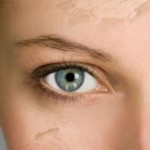 How to Deal with Your Extremely Dry Skin