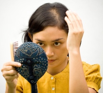 How-to-Prevent-Hair-Loss-in-Women
