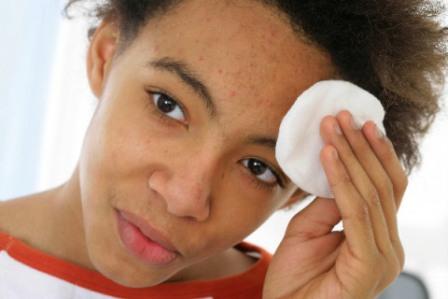 Now-a-Virus-to-Treat-Acne