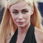 Plastic-Surgery-Goes-Wrong