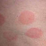 Different Types of Skin Complaints