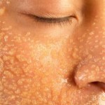 homemade-facial-scrub