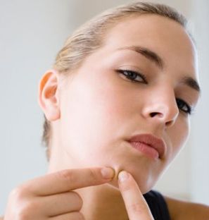 how-to-remove-blackheads