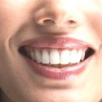 Teeth Whitening Prices – Cash vs. Effects
