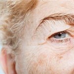 What Are Warts and How Should You Treat Them?