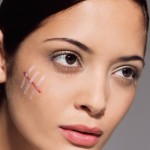 treat stitch scars effectively