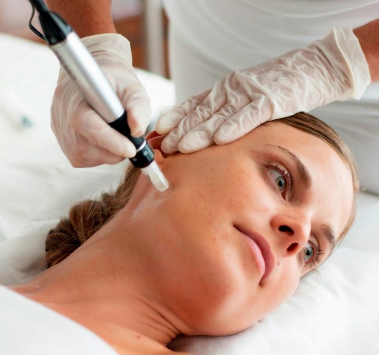 all about collagen induction therapy