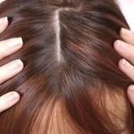 dandruff VS dry scalp