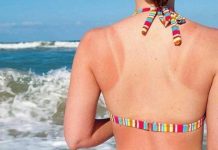 Effective Home Remedies to Get Rid of Tan