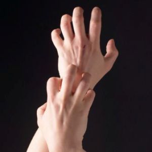 Causes of Itchy Skin Causes of Itchy Skin